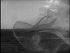 Pulsa en la imagen para verla en tamao completo

Nombre: vlcsnap-2011-06-21-10h49m50s47.png
Visitas: 32
Tamao: 326.1 KB
ID: 16515